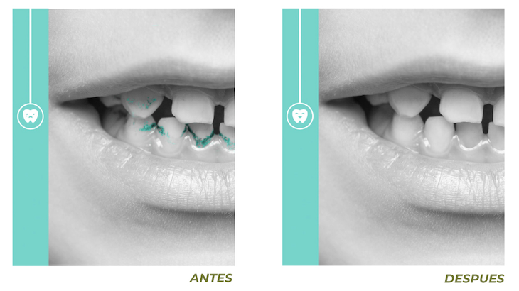 Odontología Infantil