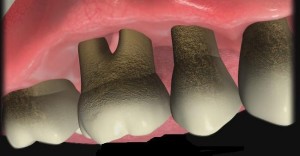 Periodoncia 5